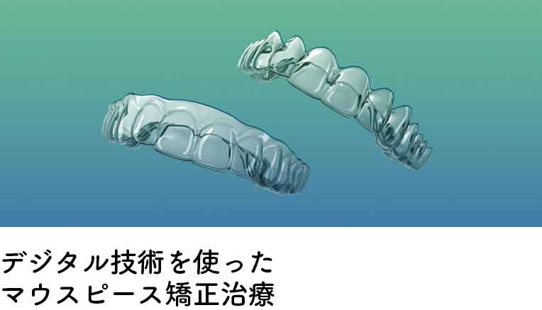 デジタル技術を使ったマウスピース矯正治療 